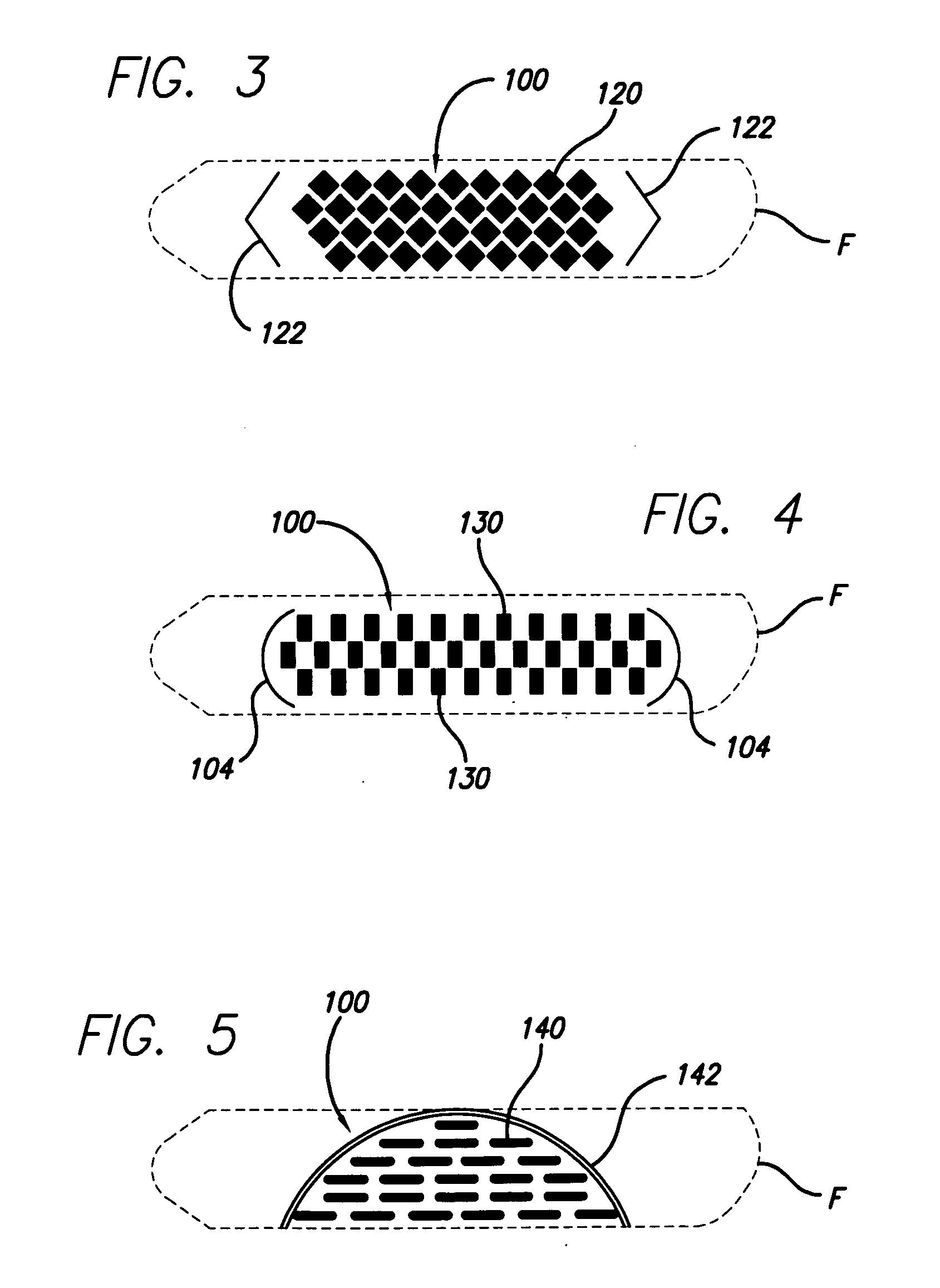 Golf club head having intermittent grooves with filled polymer