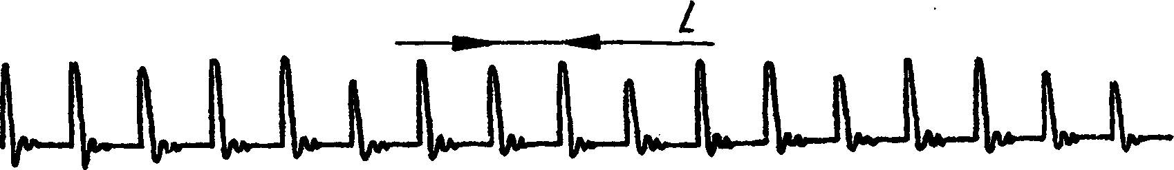 Forward error correction in speech coding