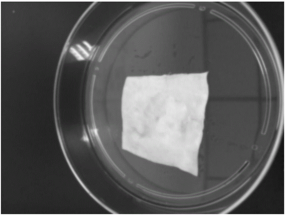 Absorbable fundal mesh composite and preparation method thereof