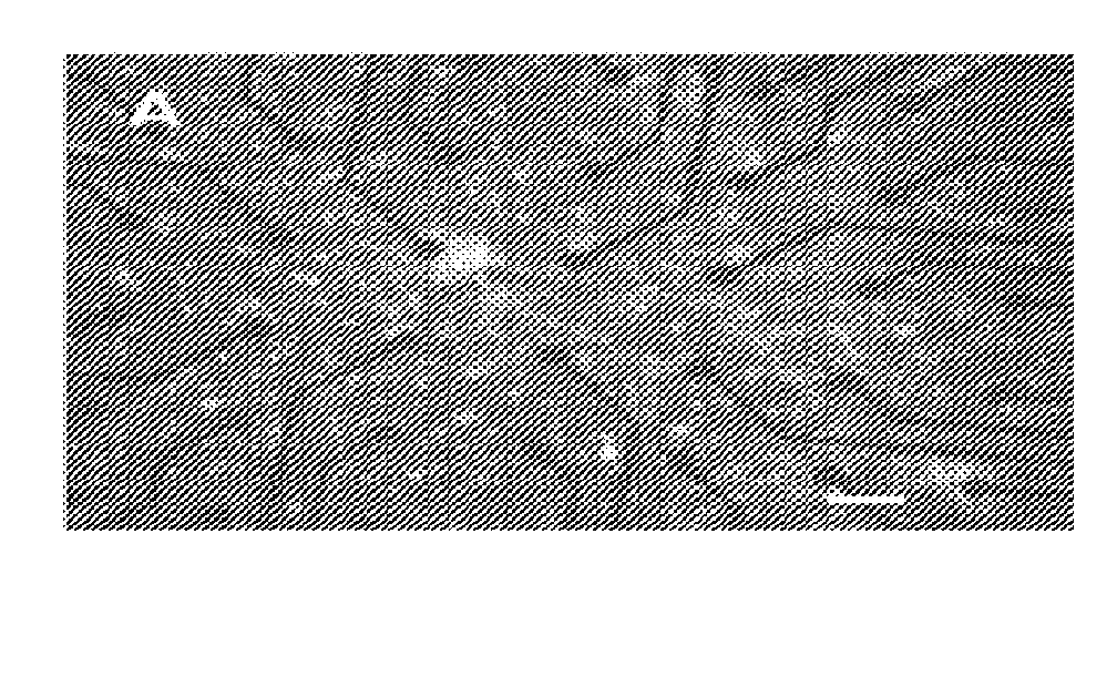 Method Of Screening Drugs For Reversal Of Amyloid Beta Neurotoxicity