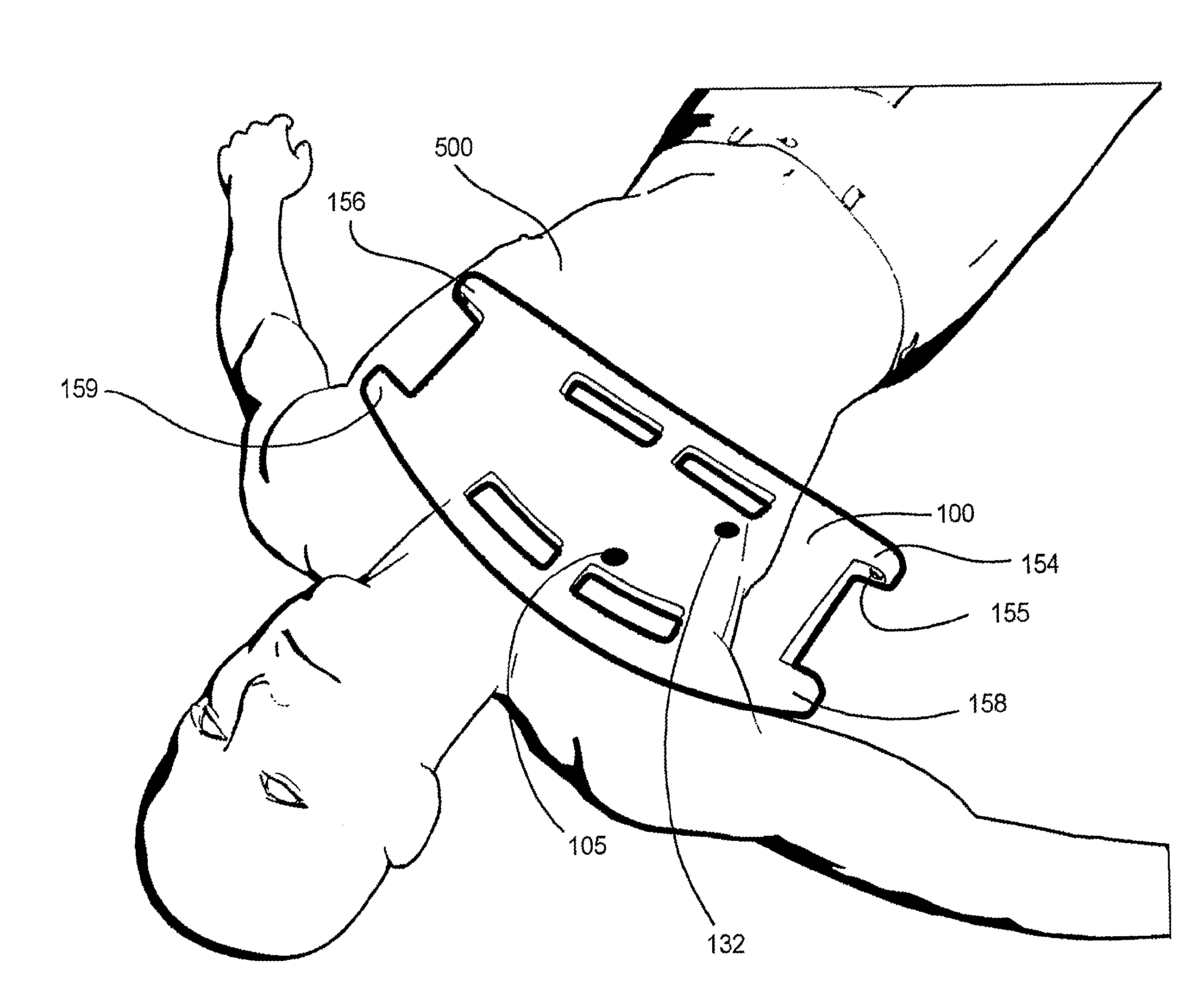 ECG electrode and electrode support