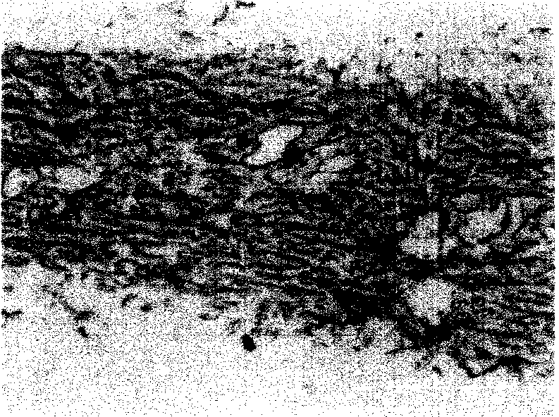 Heterogeneous dermis reticular layer stent without basement membrane and cell as well as preparation method thereof