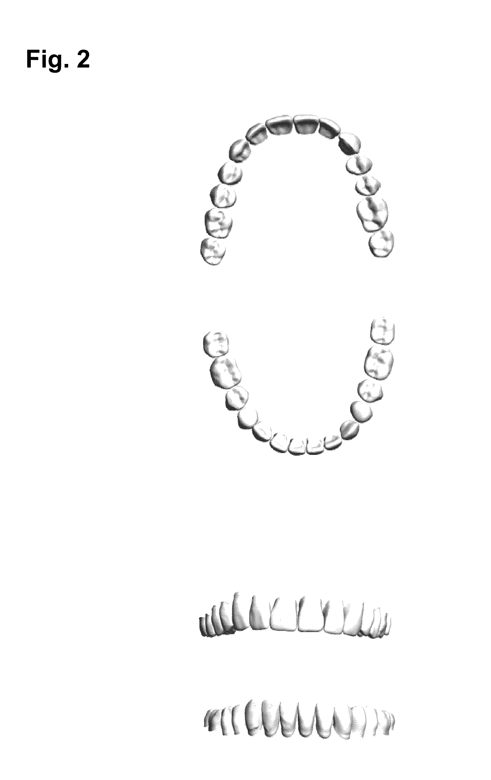 Photo-curable resin compositions and method of using the same in three-dimensional printing for manufacturing artificial teeth and denture base