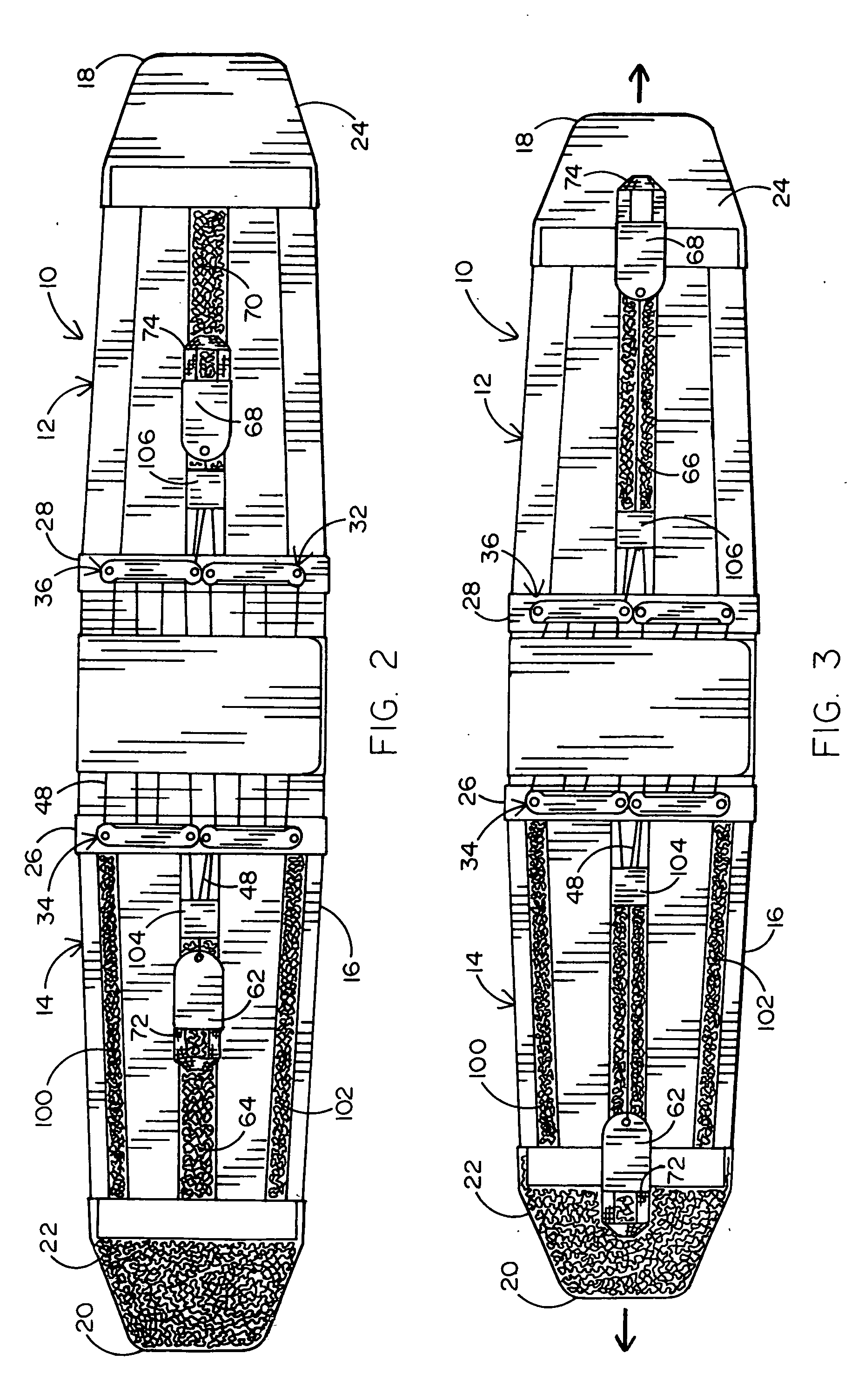 Double pull body brace