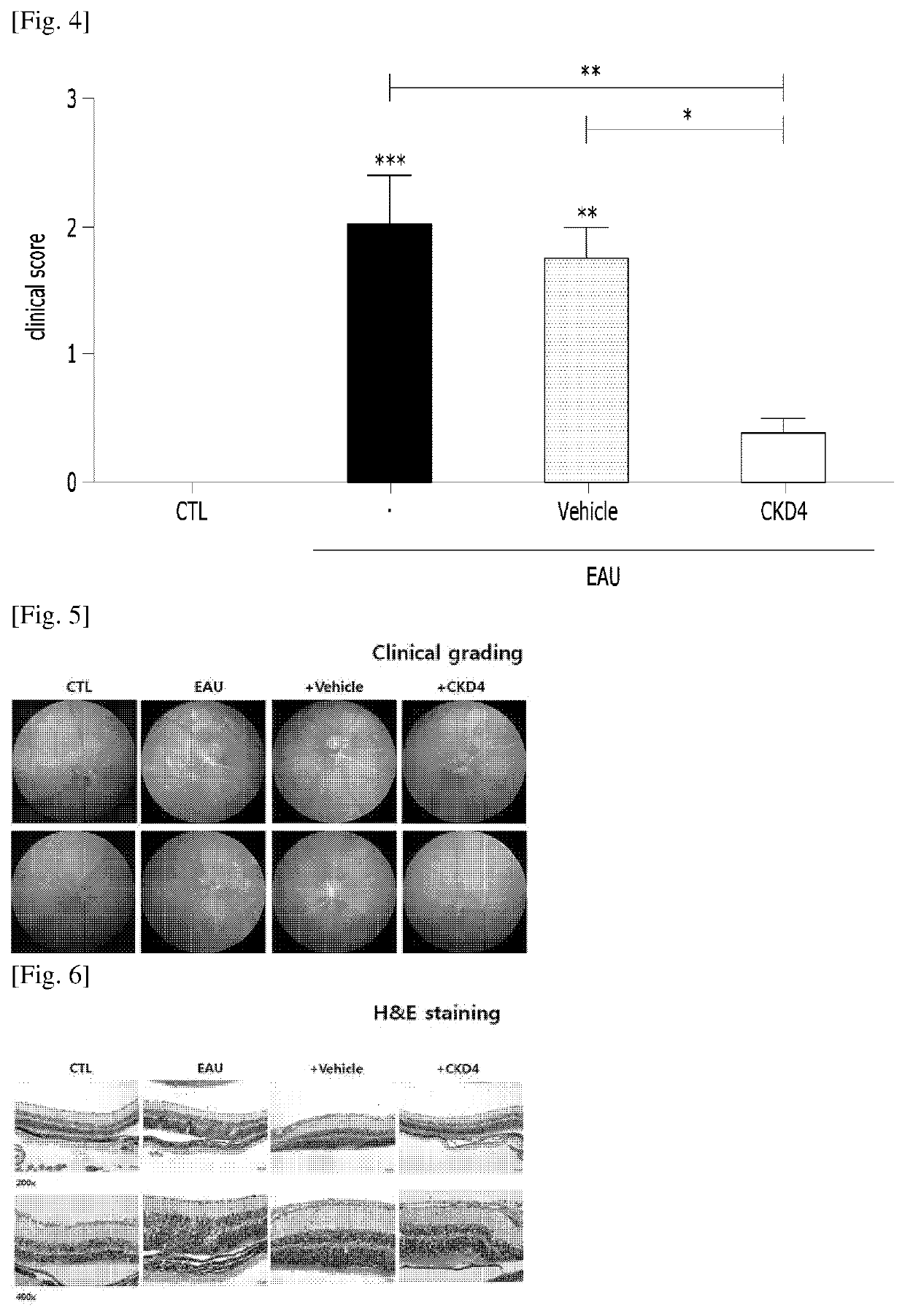 Compositions for preventing or treating uveitis