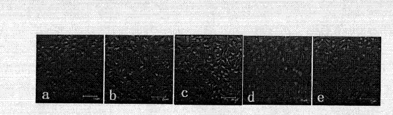 Folic acid acceptor mediated molecular targeted photosensitizer and preparation method thereof