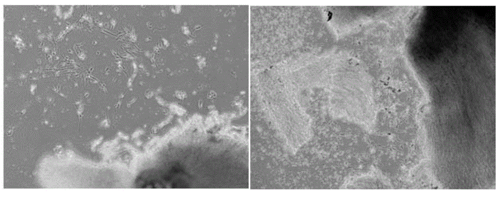 Umbilical cord mesenchymal stem cell separation method