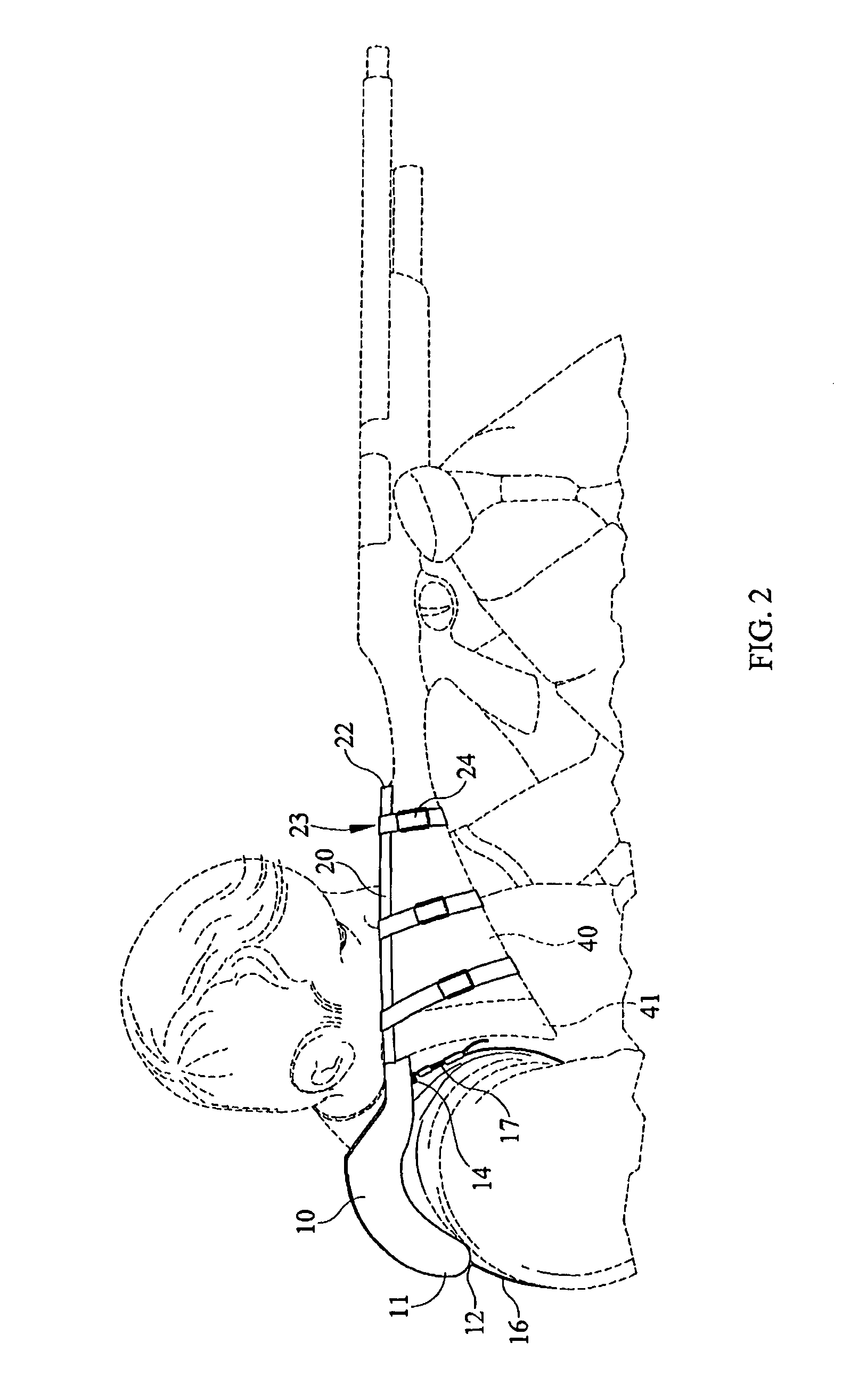 Hands-free firearm stabilizer