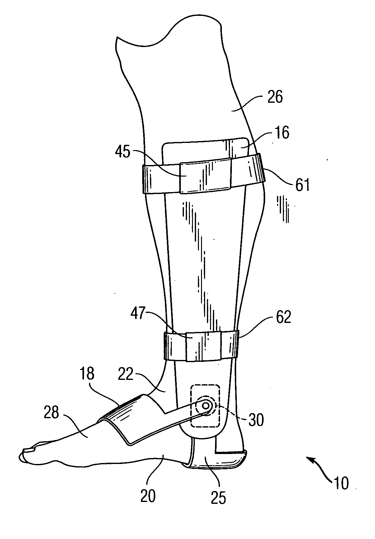 Ankle brace