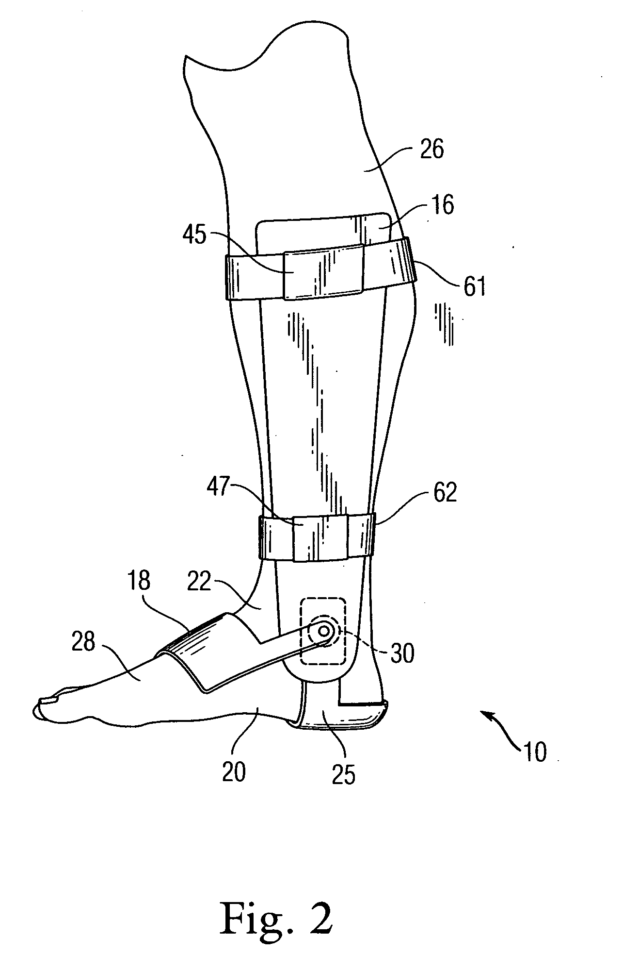 Ankle brace