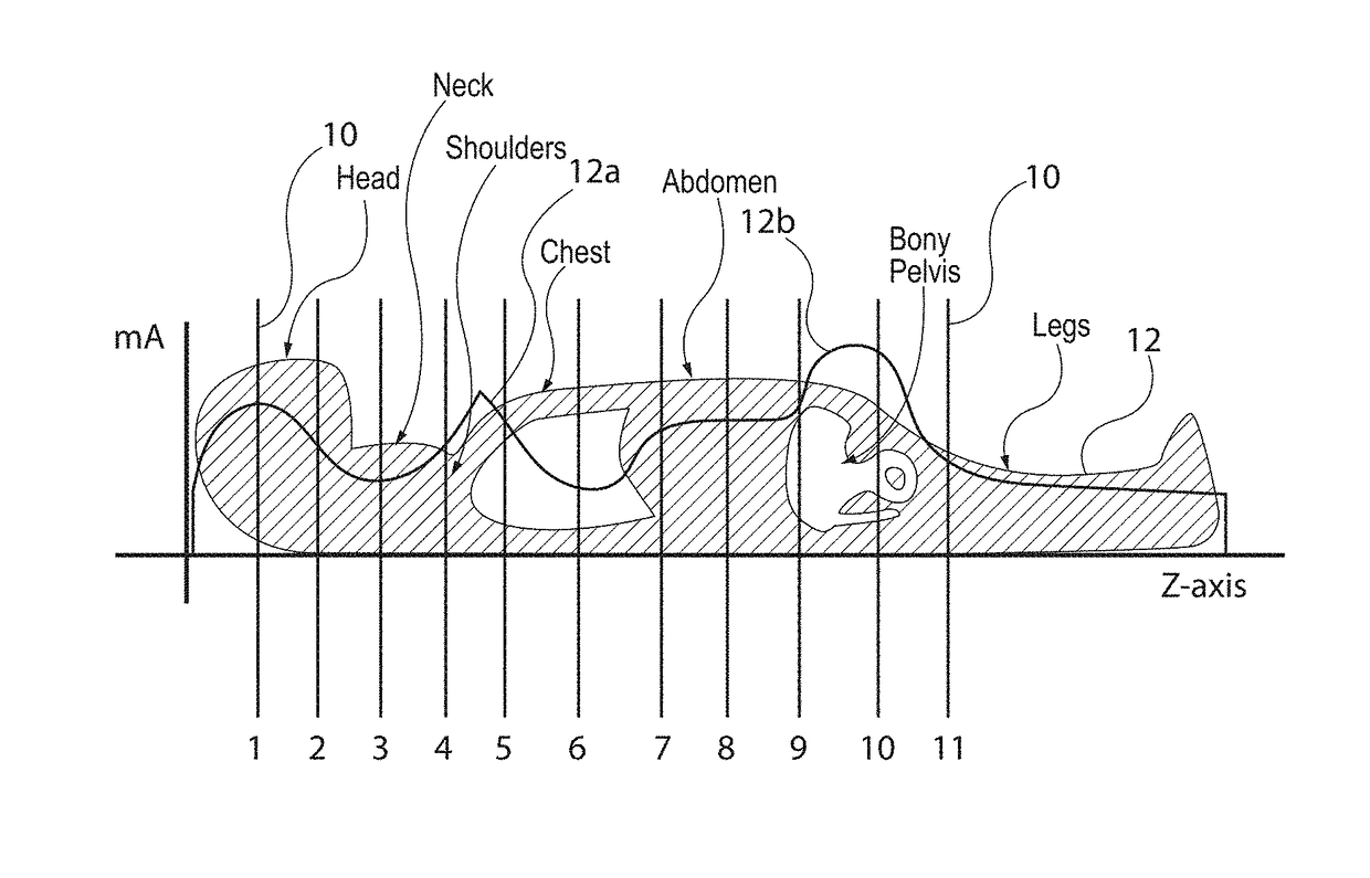 Image processing system and method for detecting an anatomical marker within an image study