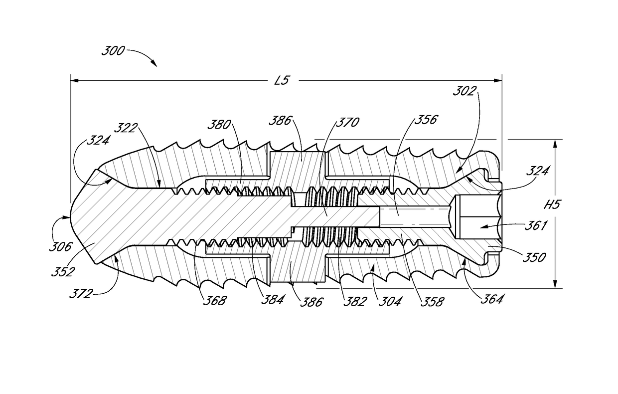 Expandable interbody device