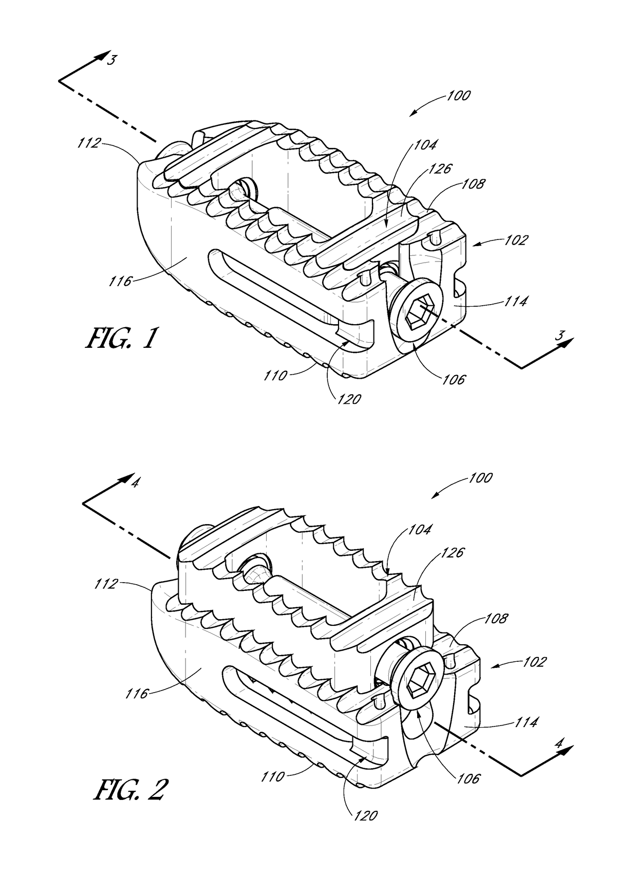 Expandable interbody device