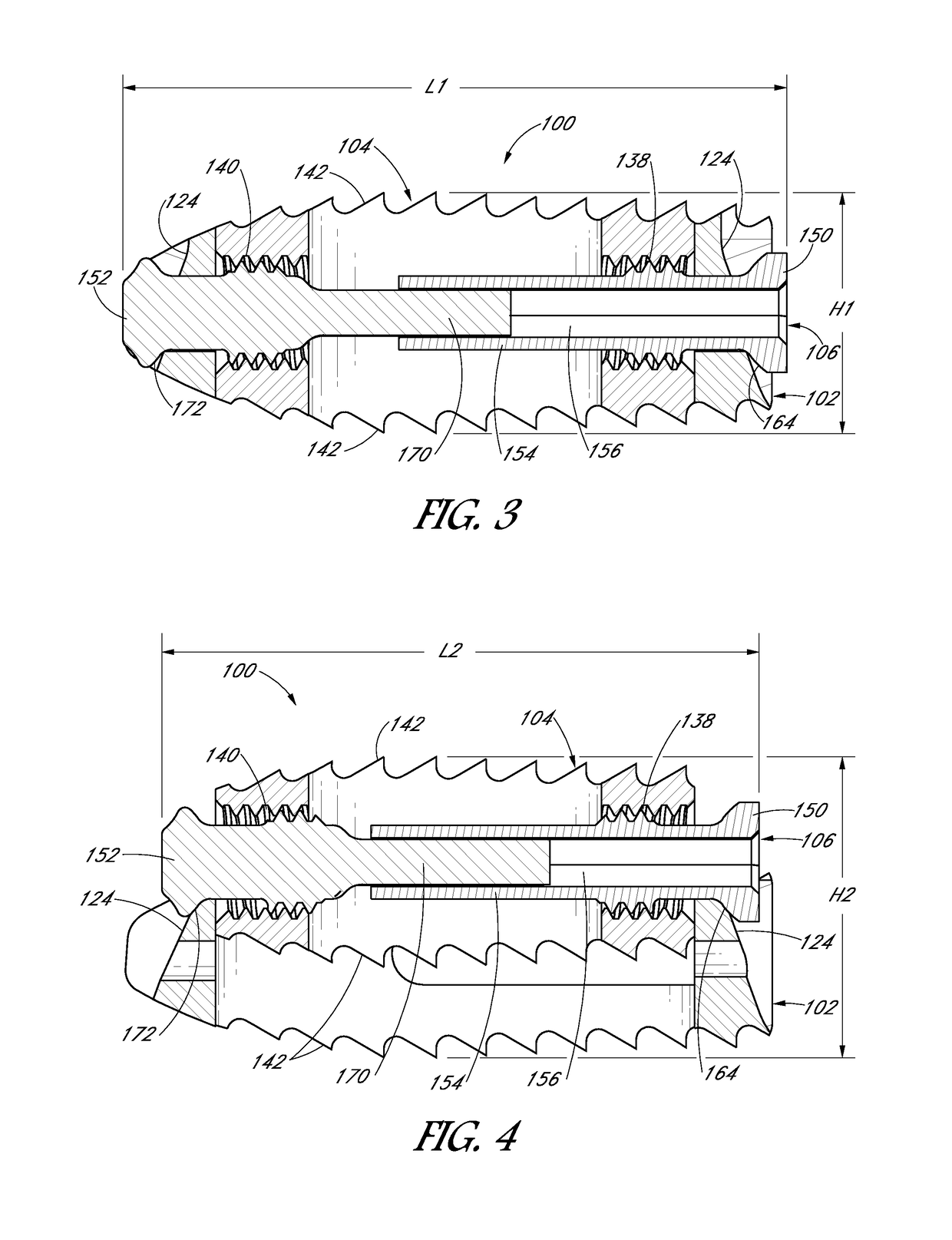 Expandable interbody device