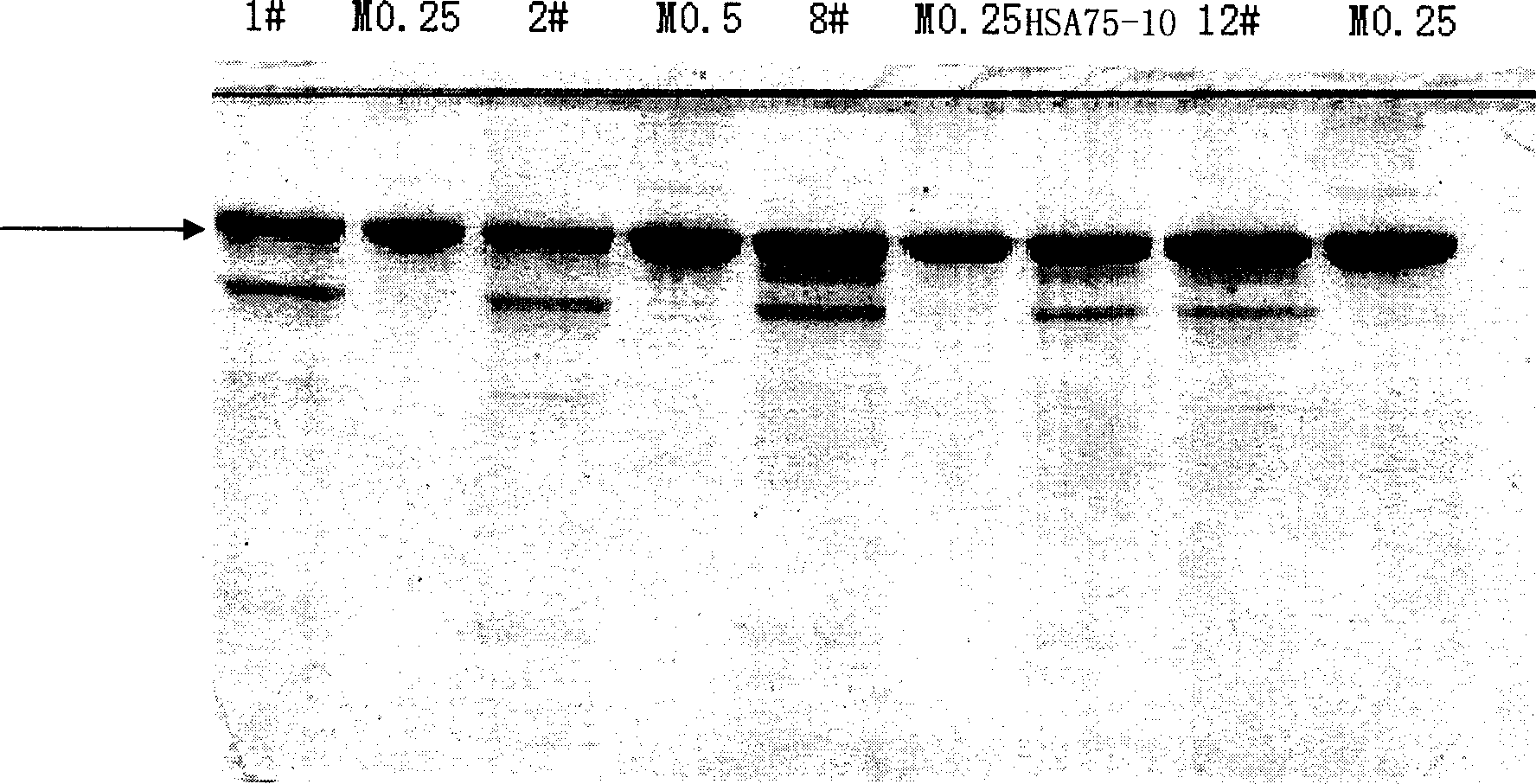 Expression human seralbumin carrier and engineering bacterium