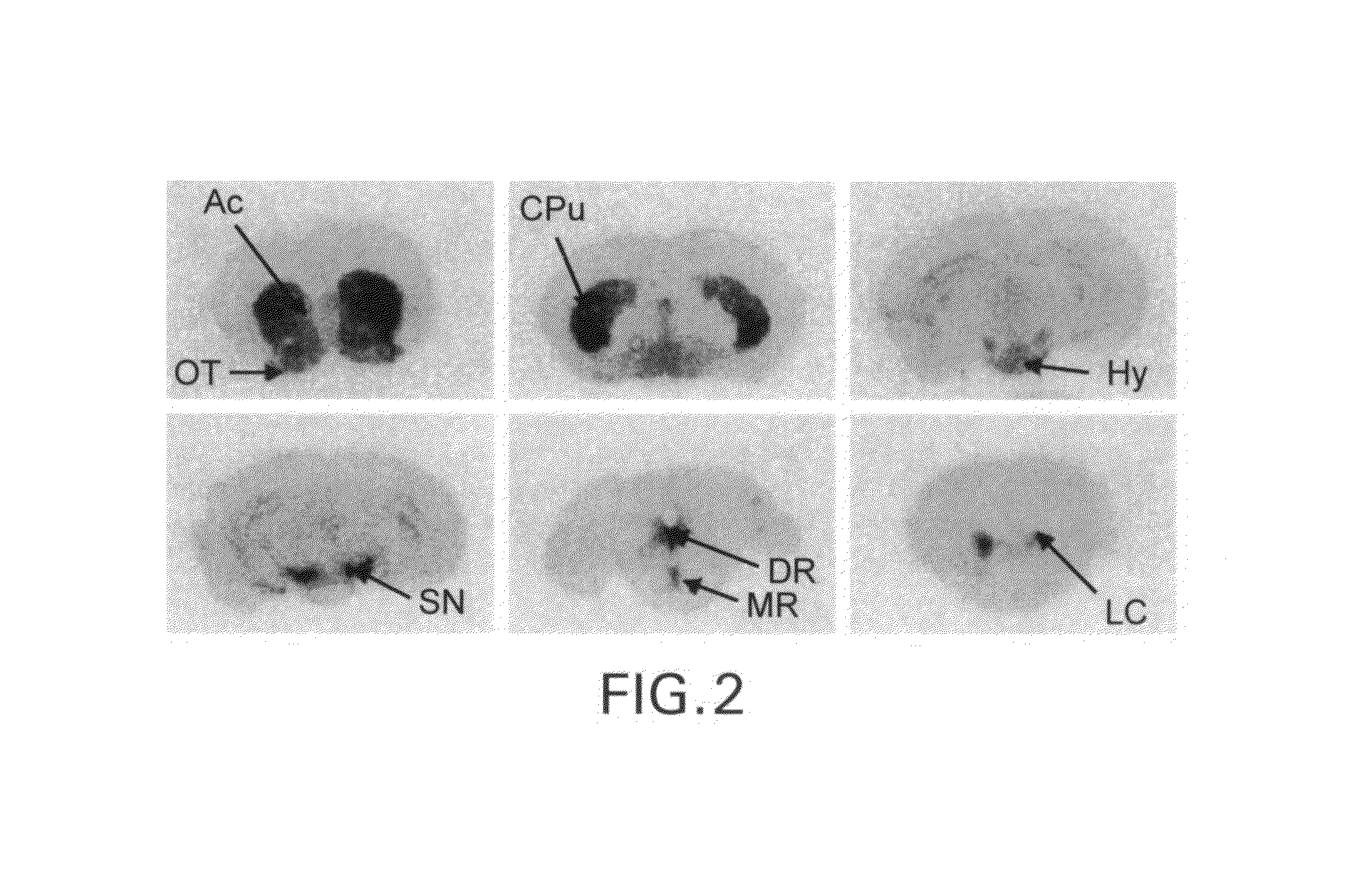 Radiolabeled dihydrotetrabenazine derivatives and their use as imaging agents