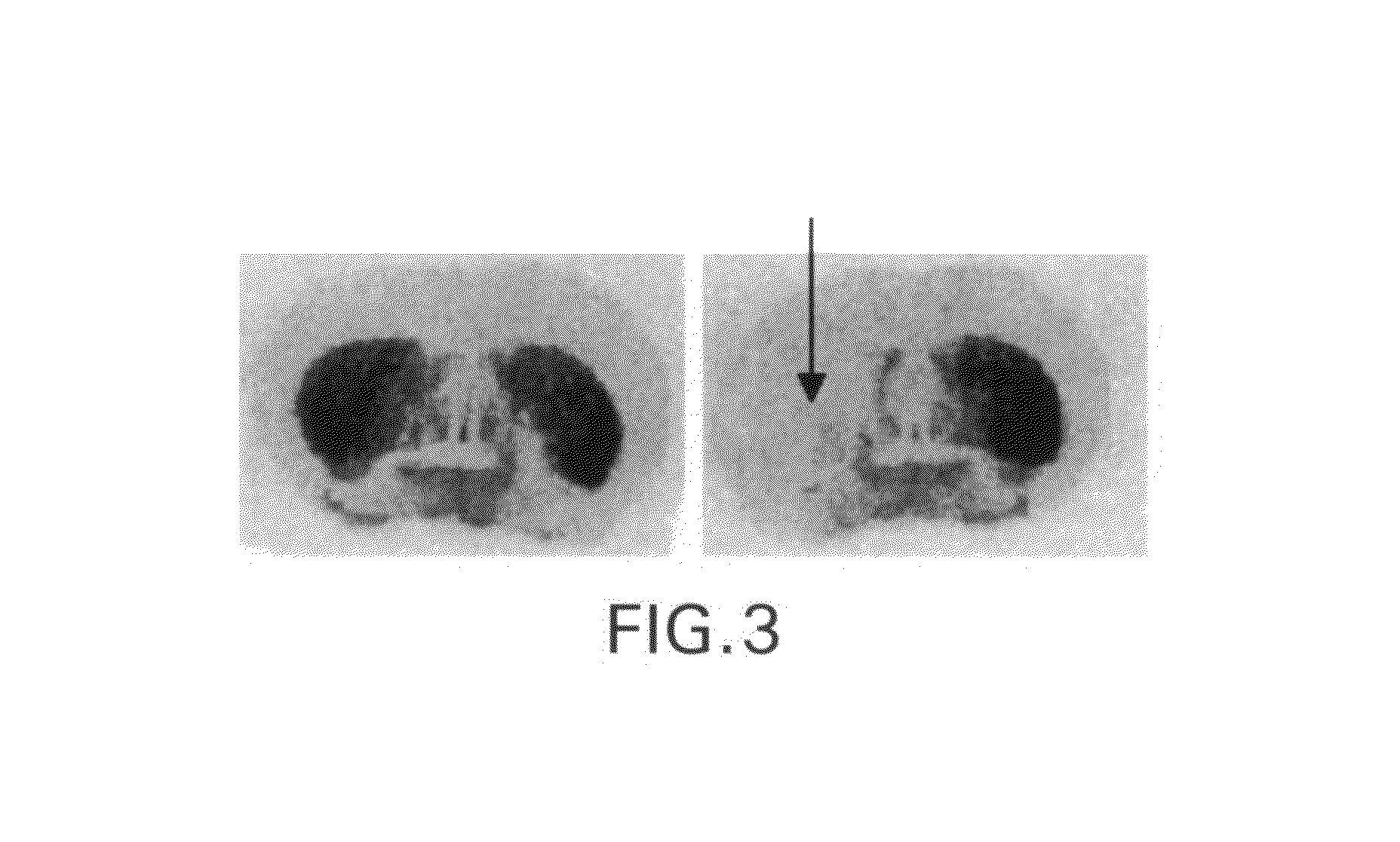 Radiolabeled dihydrotetrabenazine derivatives and their use as imaging agents