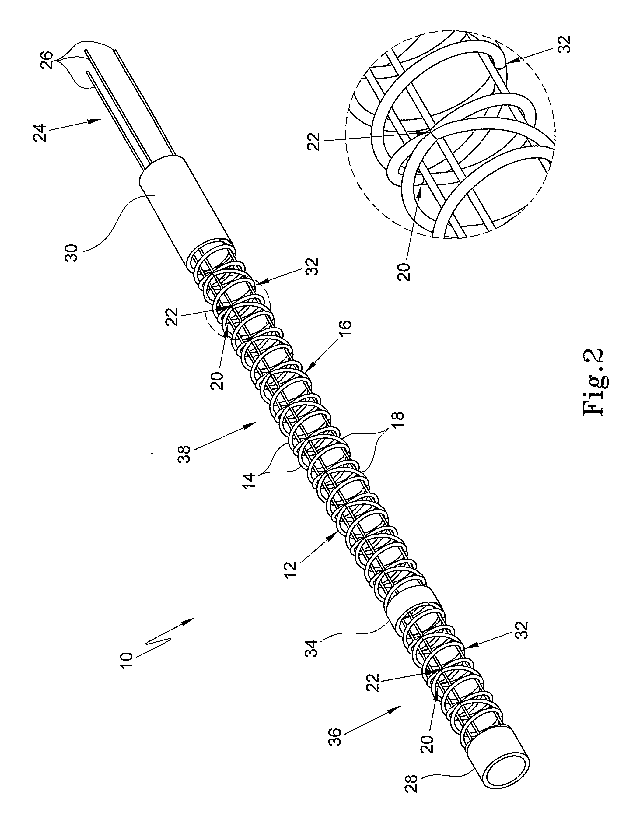 Sleeve Steering and Reinforcement