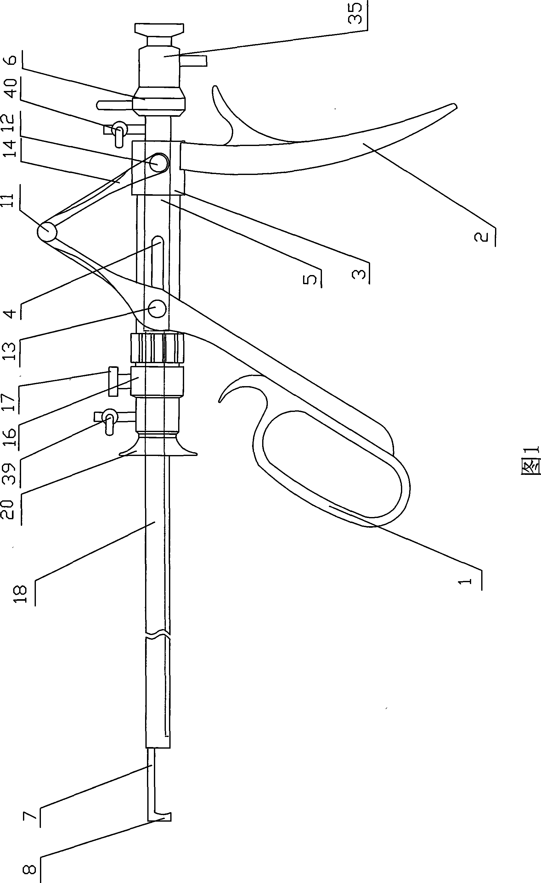 Diagnosis and treatment system for human urethral calculus