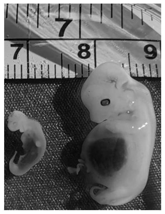 Application of PSAP gene in preparation of product for detecting embryo death in early stage of pig pregnancy