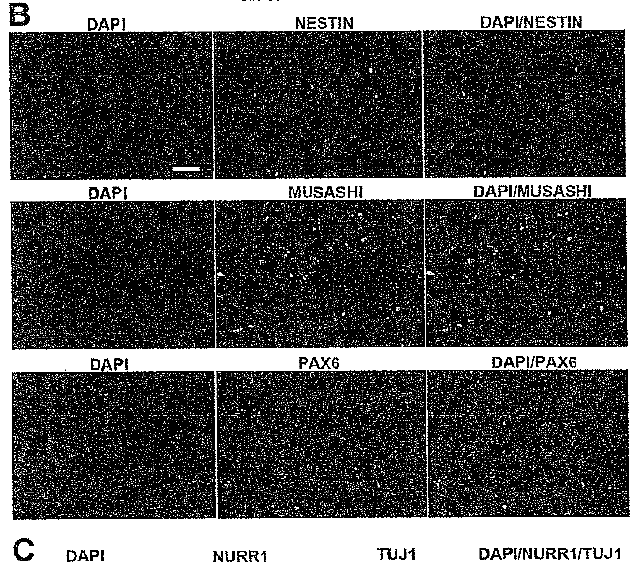 Use of neural cells derived from human pluripotent stem cells for the treatment of neurodegenerative diseases