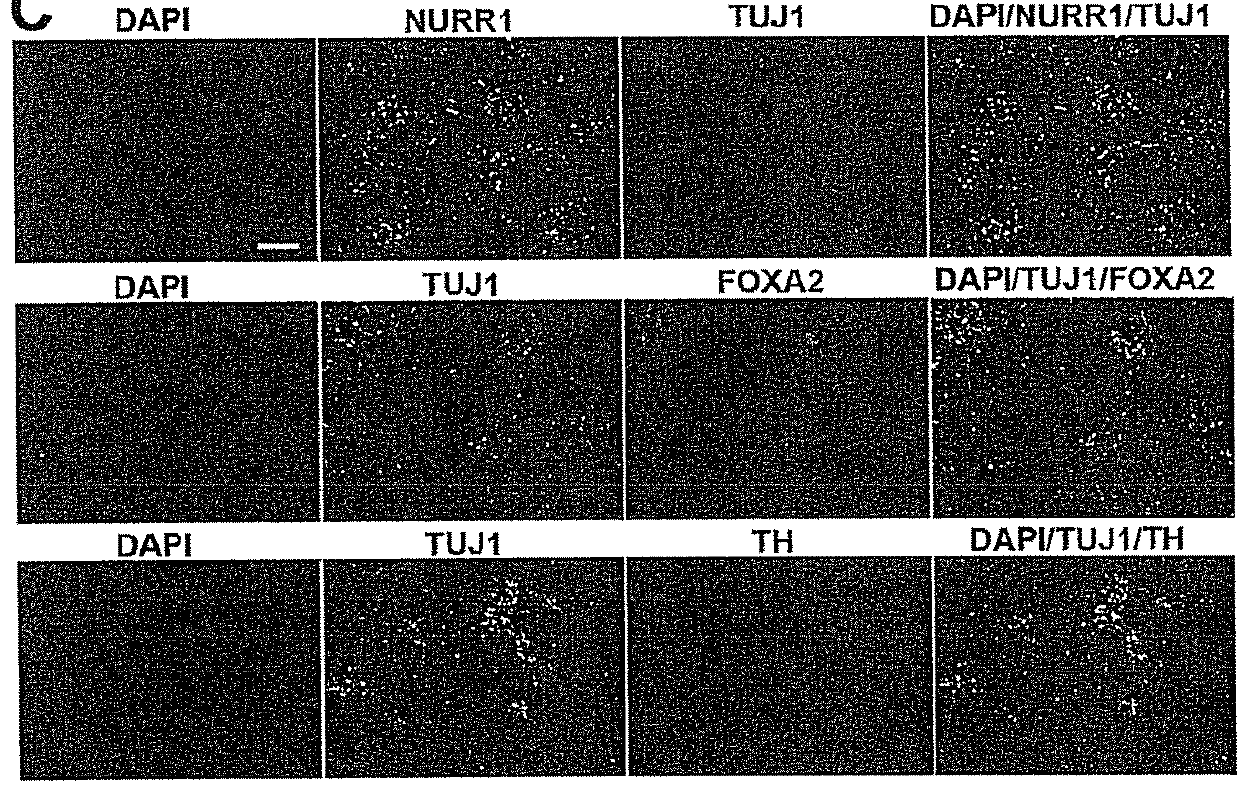 Use of neural cells derived from human pluripotent stem cells for the treatment of neurodegenerative diseases