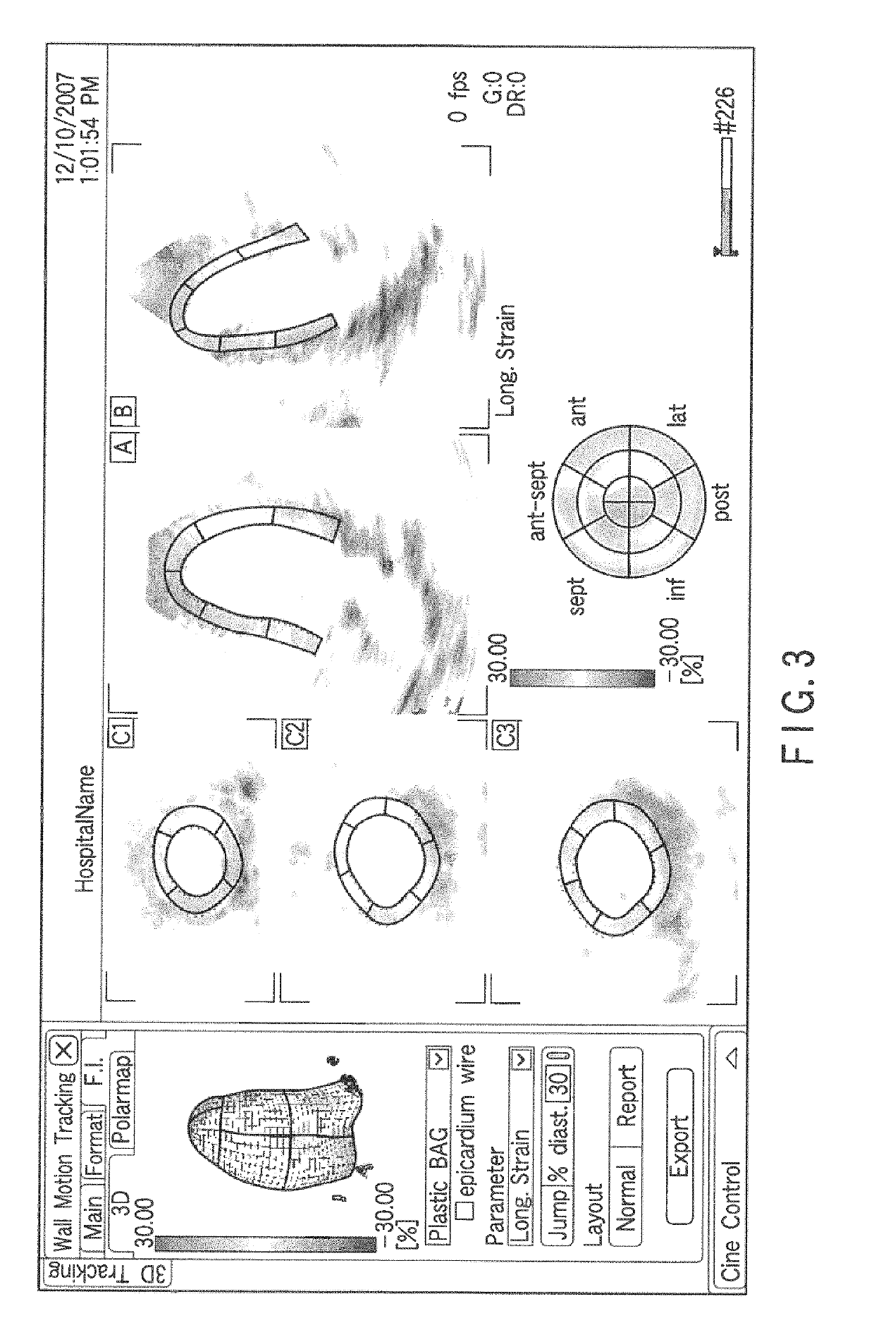 Ultrasonic diagnostic apparatus, ultrasonic image display apparatus, and medical image diagnostic apparatus