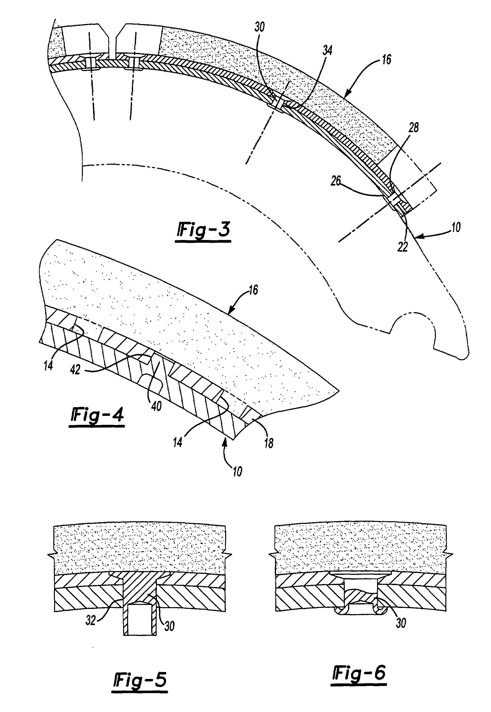 Brake shoe and brake lining blocks with keyed connection