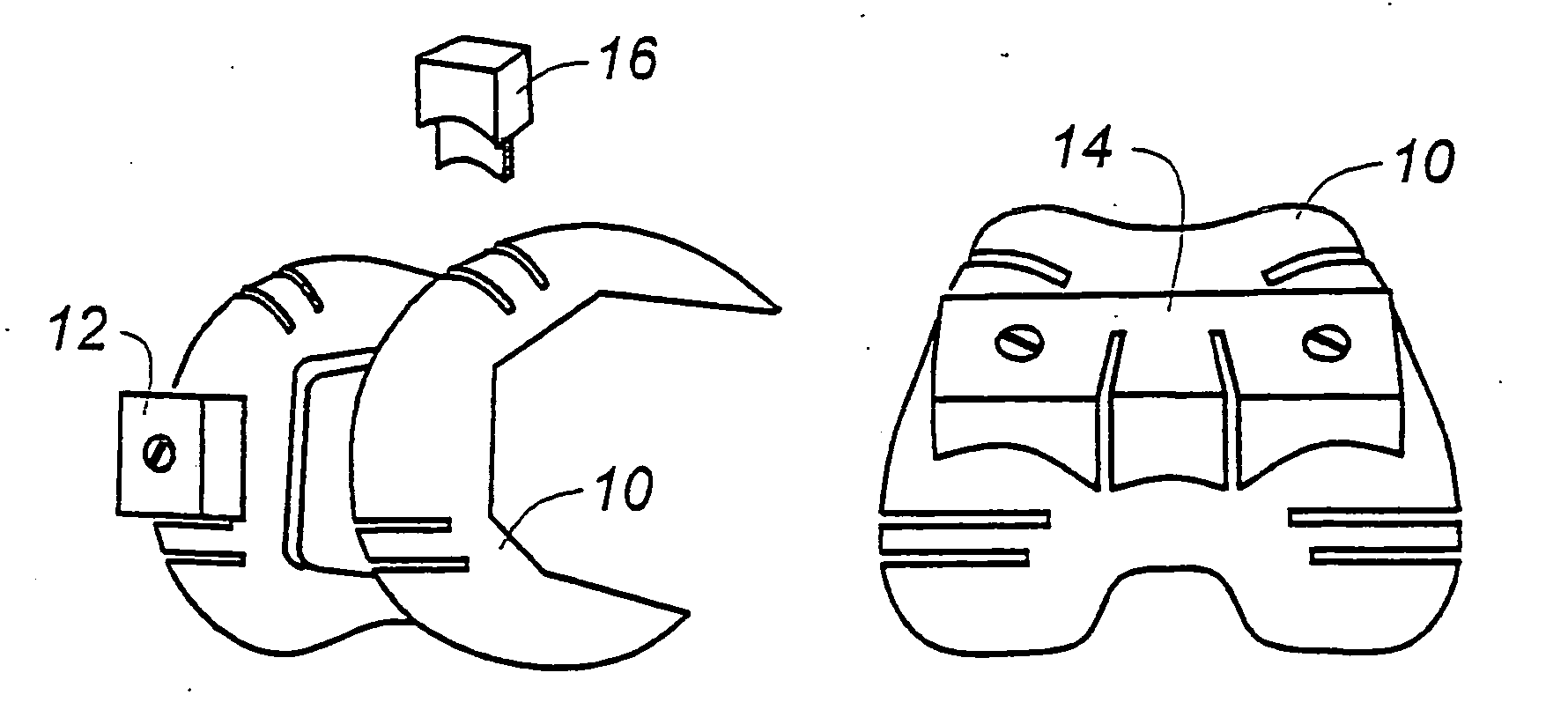 Joint replacement methods and apparatus