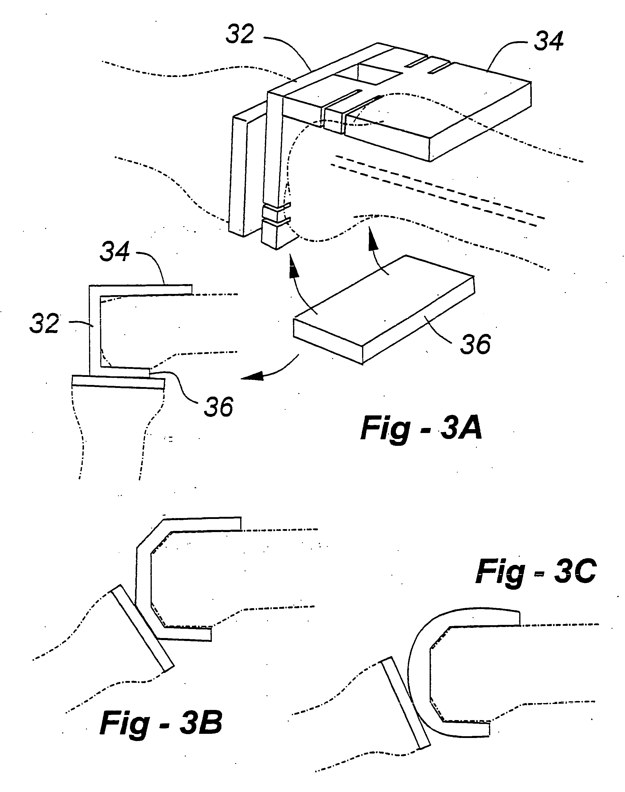 Joint replacement methods and apparatus