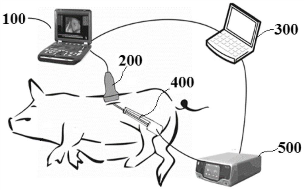 Respiration separation type strain imaging method based on ultrasonic images of living body