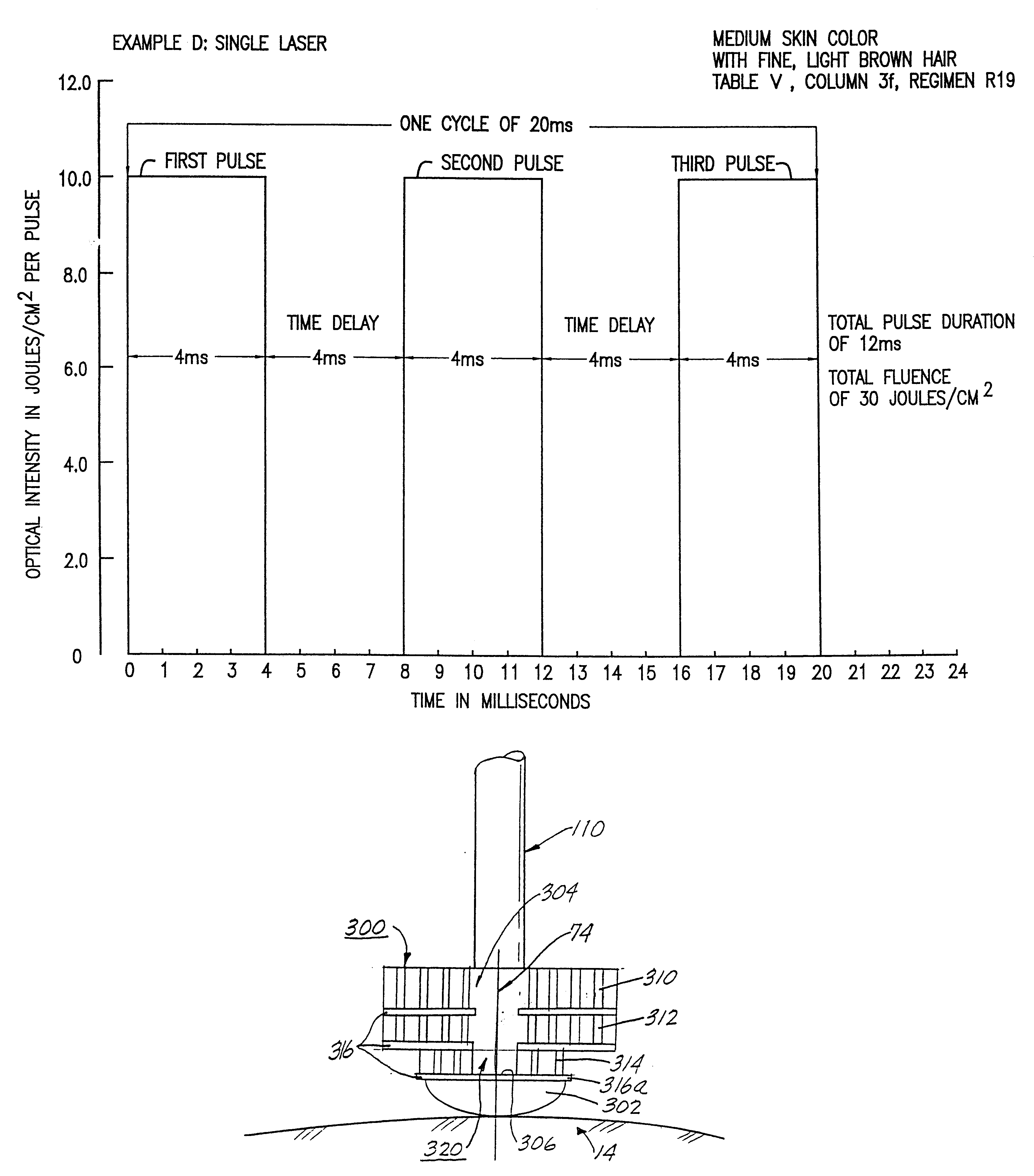 Apparatus and method employing parametrically defined pulse groups for laser hair removal