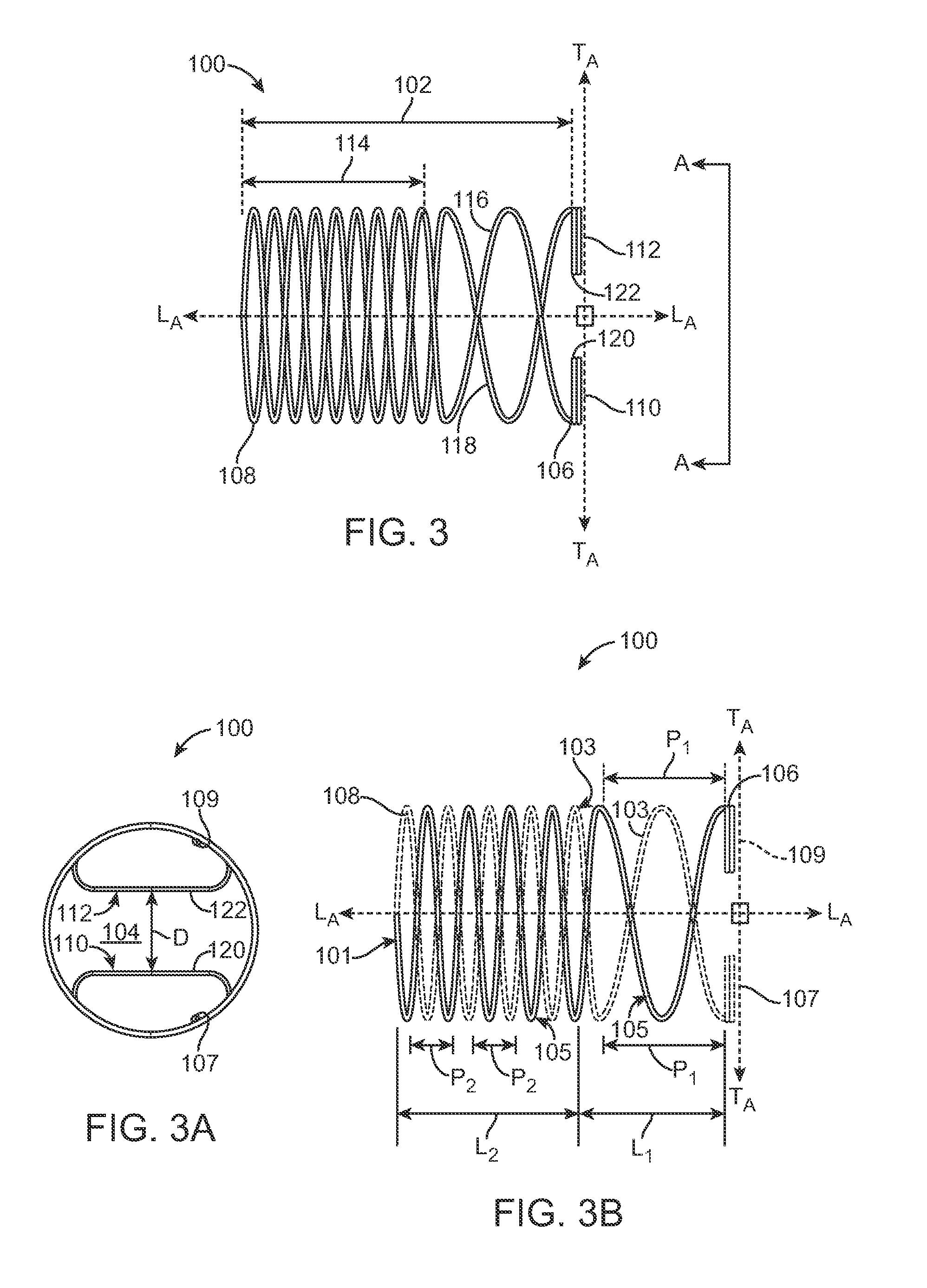 Venous valve repair prosthesis for treatment of chronic venous insufficiency