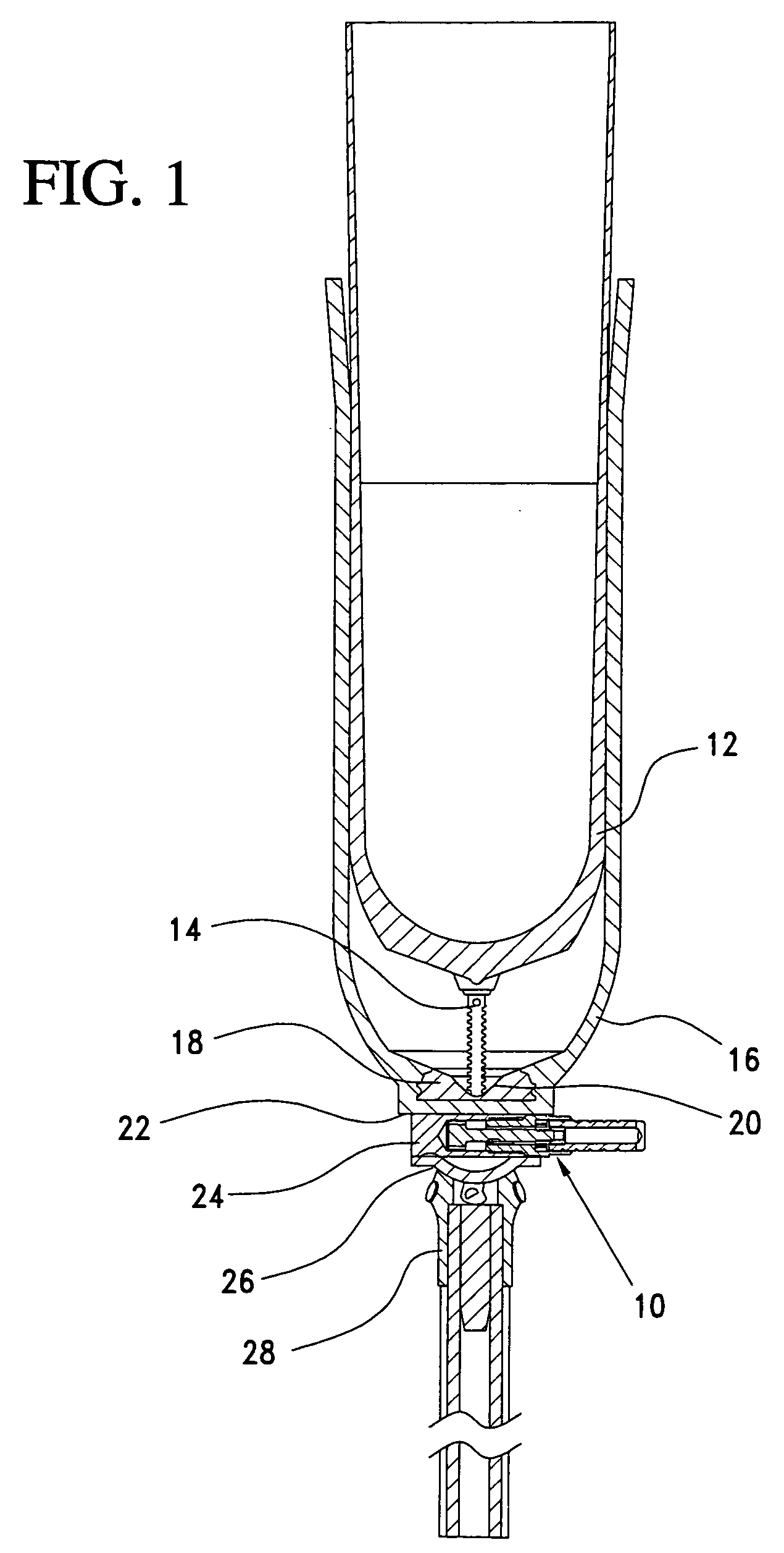 Prosthesis locking assembly