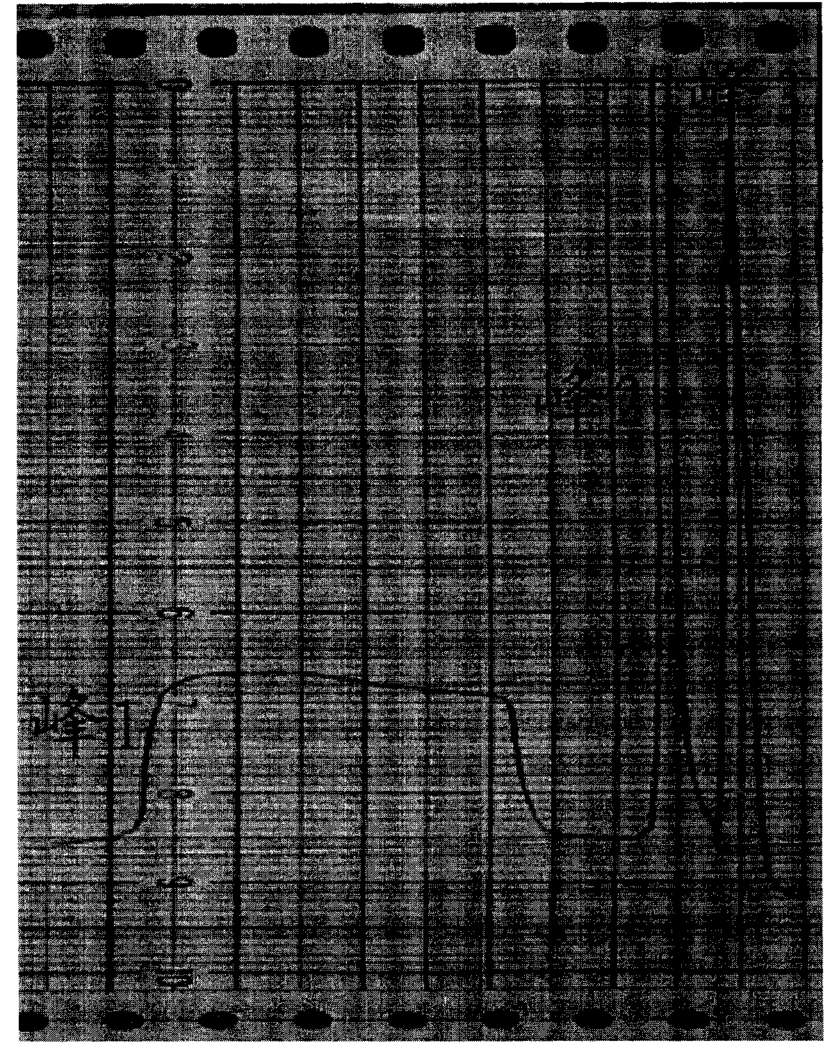 Method for producing recombinant human serum albumin-interferon alpha 2b