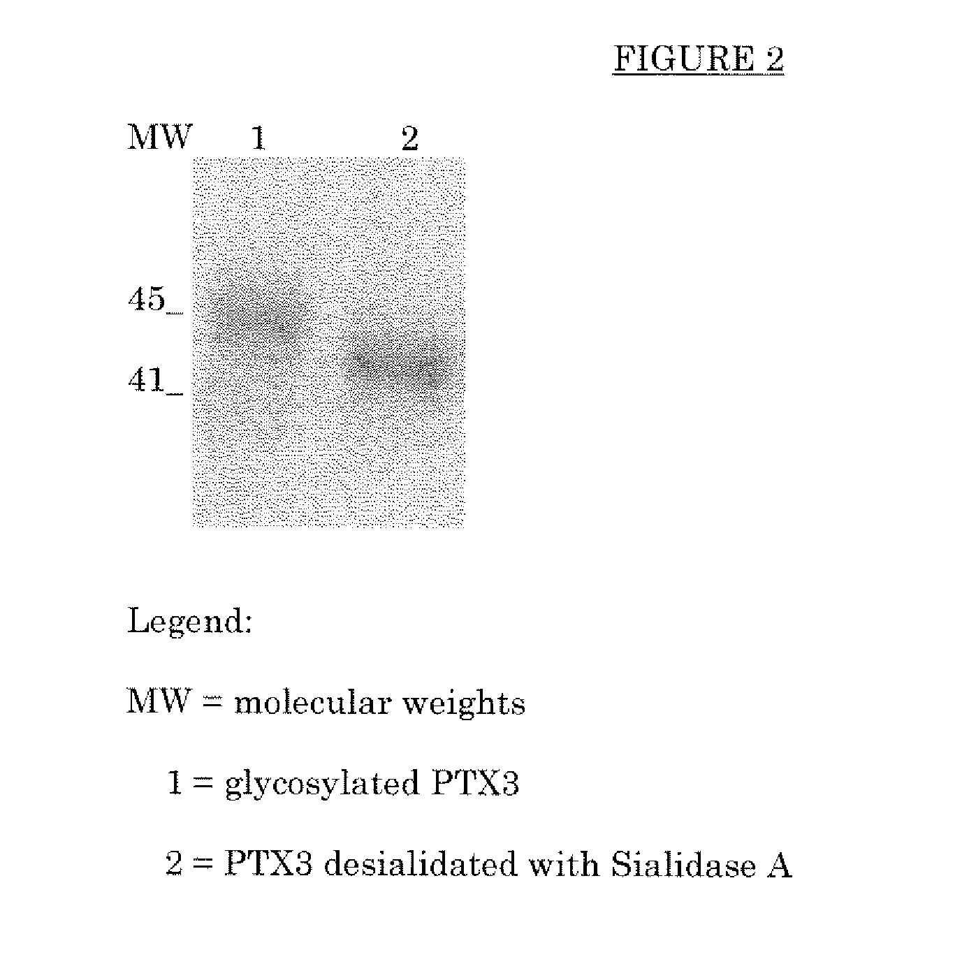 Deglycosylated and desialidated long pentraxin PTX3