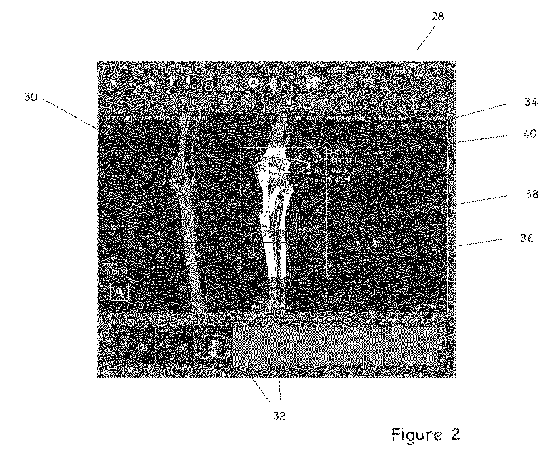 Client-server visualization system with hybrid data processing