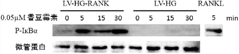 Fusion protein capable of targeting activation of RANK signal pathway and recombinant plasmid and application thereof