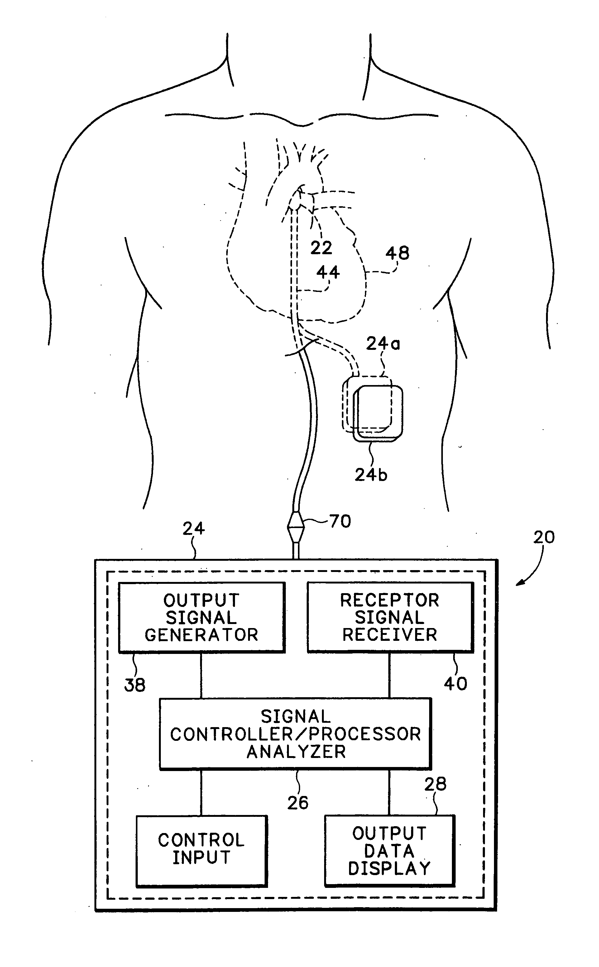 Method and apparatus for monitoring blood condition and cardiopulmonary function