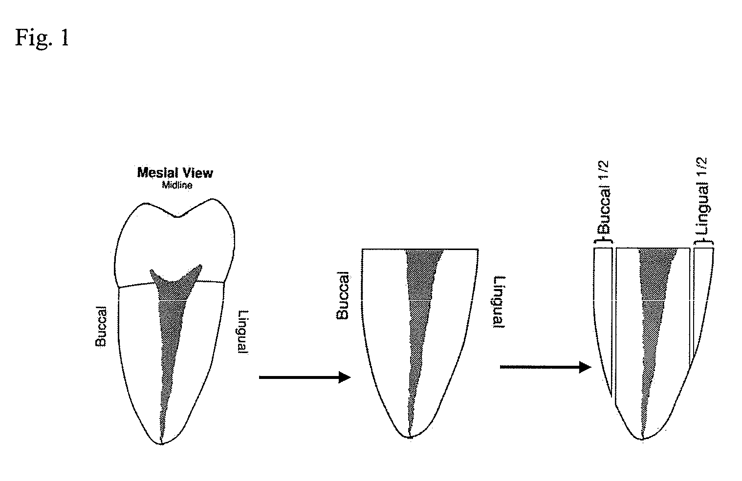 Anti-Bacterial and Mineralizing Calcium Phosphate Compositions