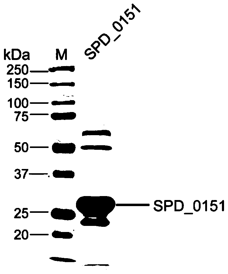 Streptococcus pneumoniae vaccine and preparation method thereof