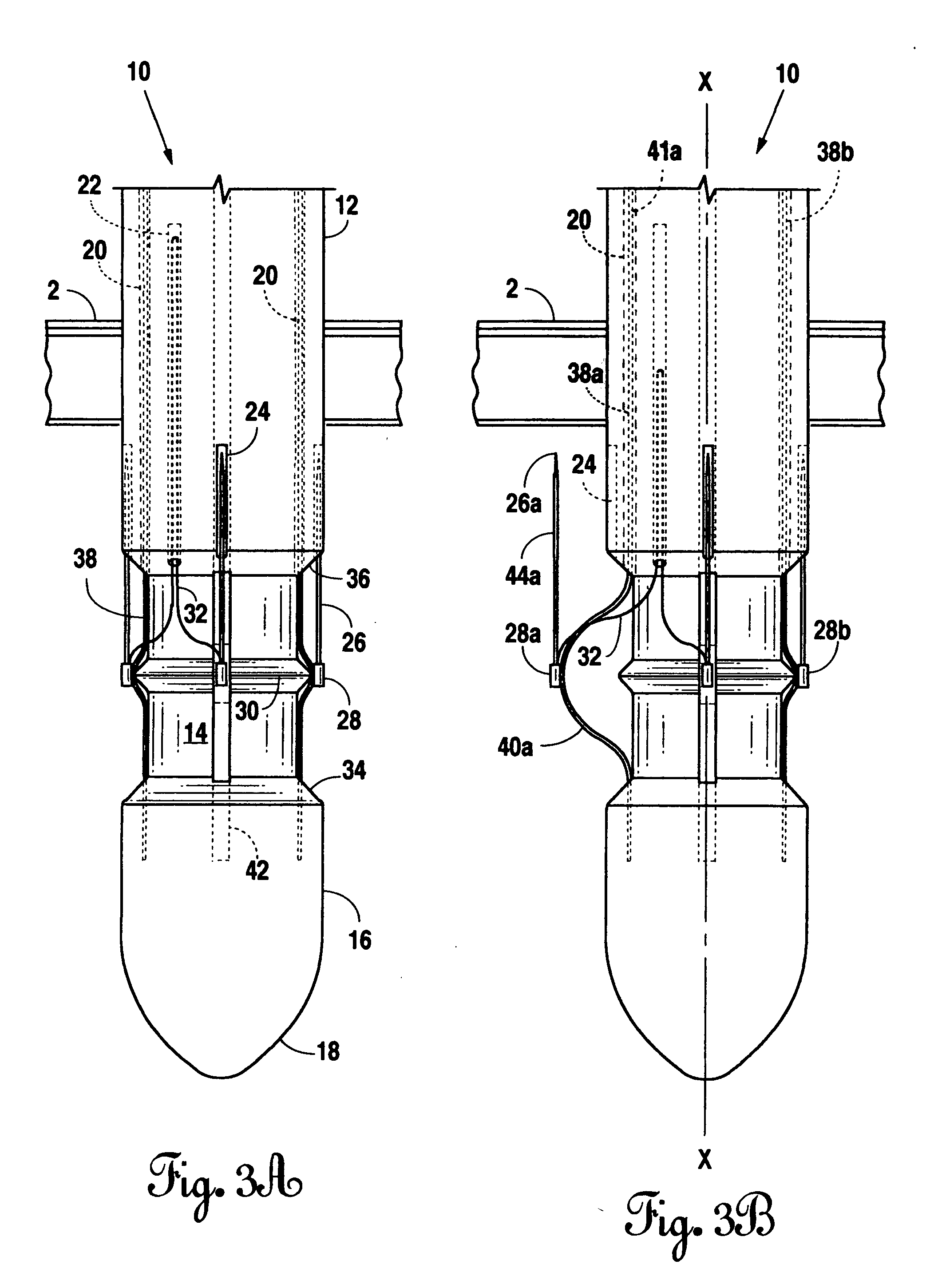 Suture device