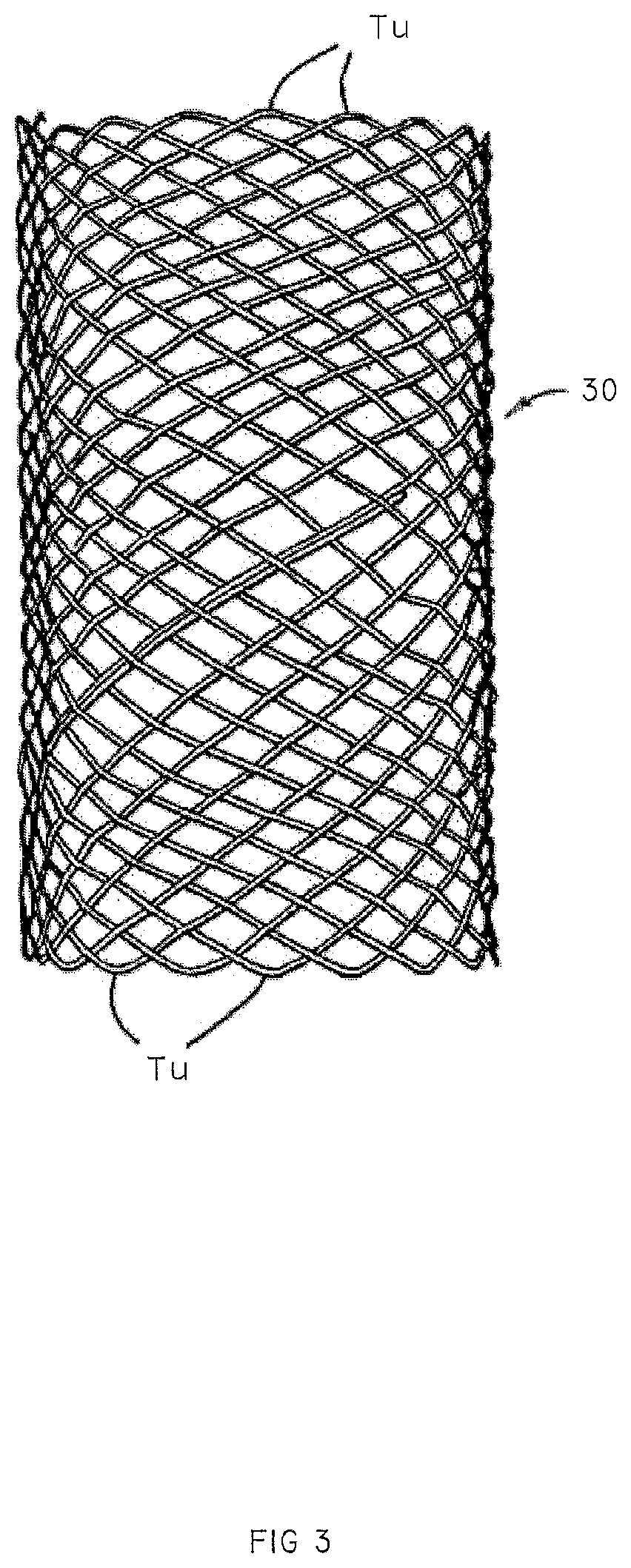 Methods and apparatus for endovascular heart valve replacement comprising tissue grasping elements