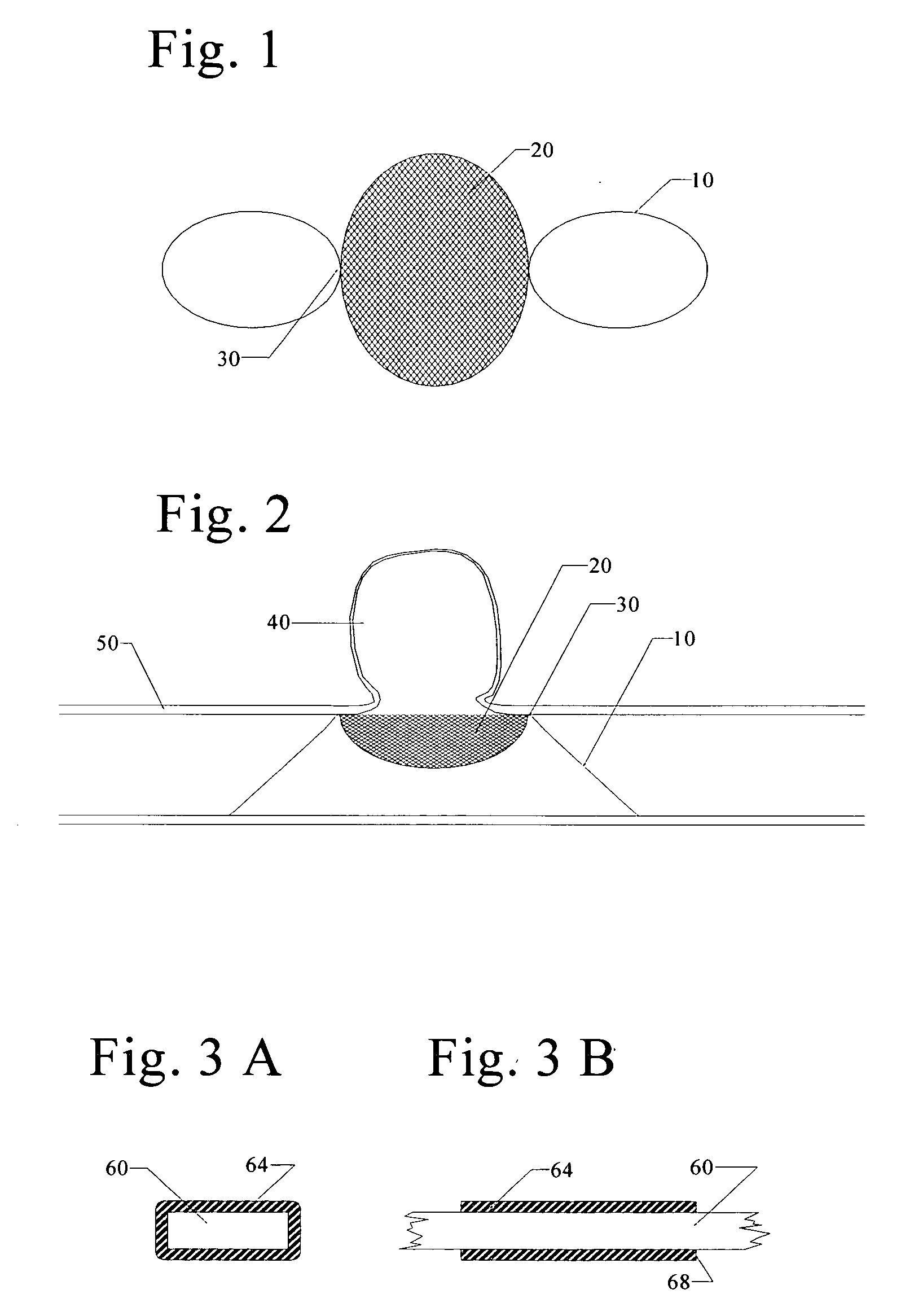 Endovascular aneurysm treatment device and delivery system