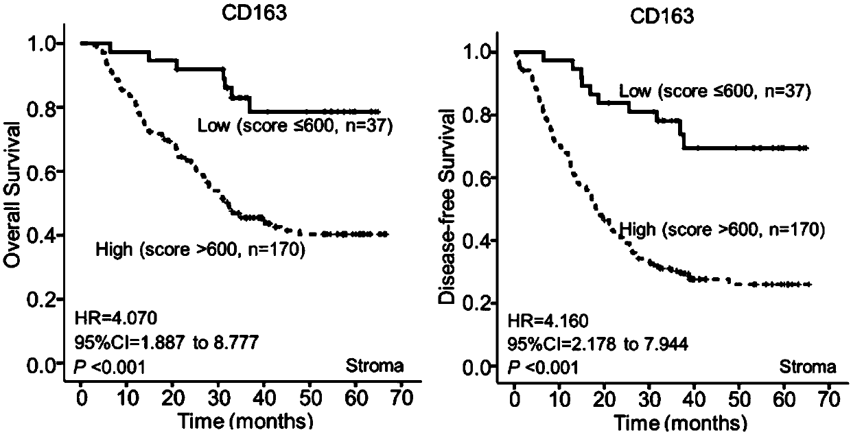 Esophageal squamous cell carcinoma microenvironmental cell marker molecular model and application thereof