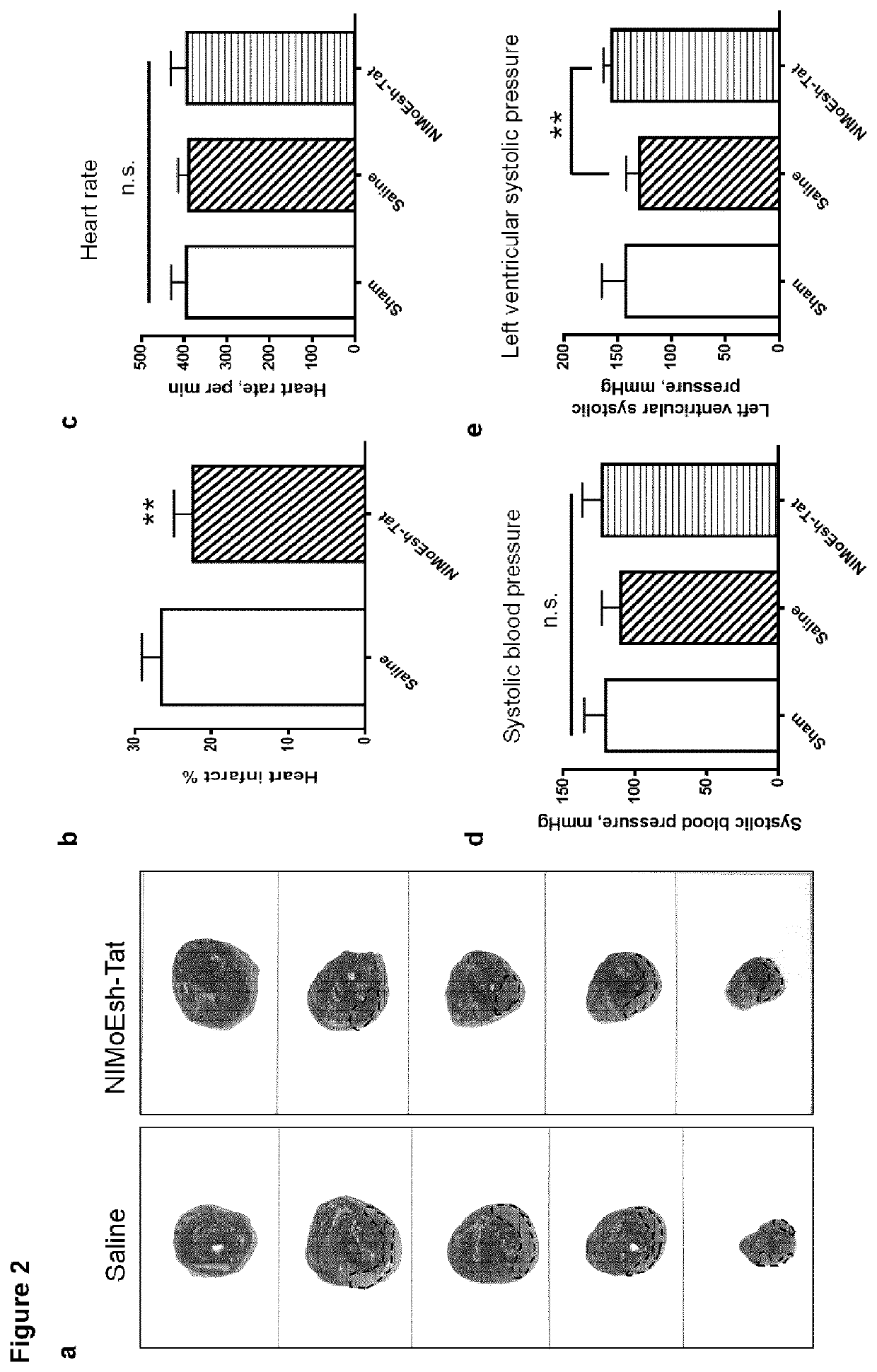 Inhibiting zd17-jnk interaction as a therapy for acute myocardial infarction