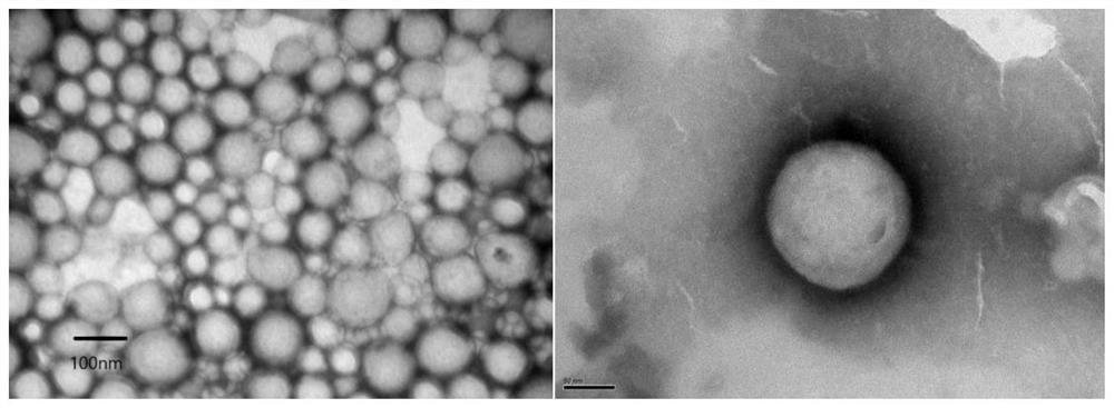 A dual-targeting polymer drug nanocarrier and its preparation method and application