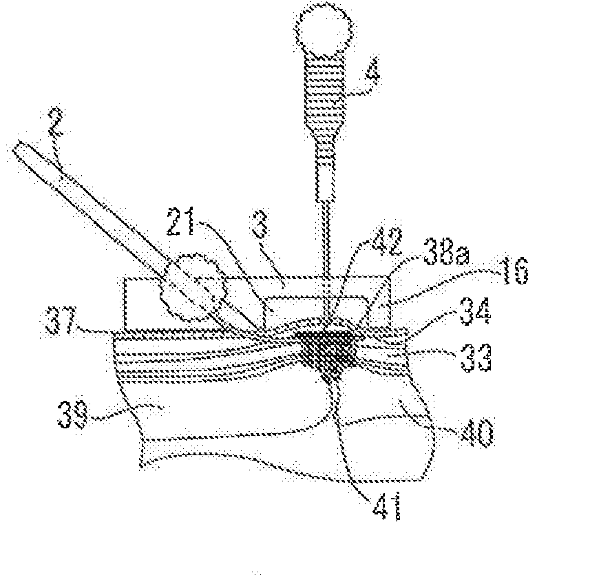 Surgical instrument for making incisions