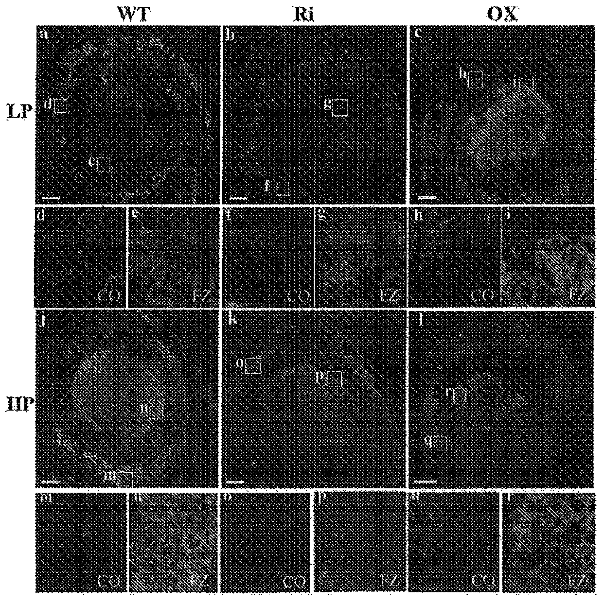 Expression of a phosphate transporter for improving plant yield