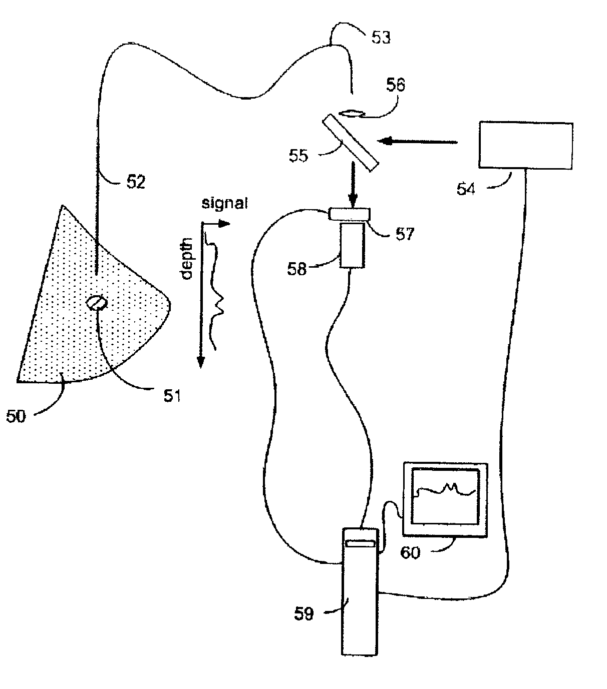 Method for Raman chemical imaging and characterization of calcification in tissue